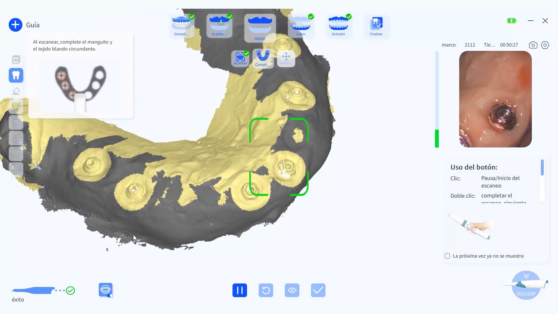 Scanbodies Aura Smart+ - My Lab Dental