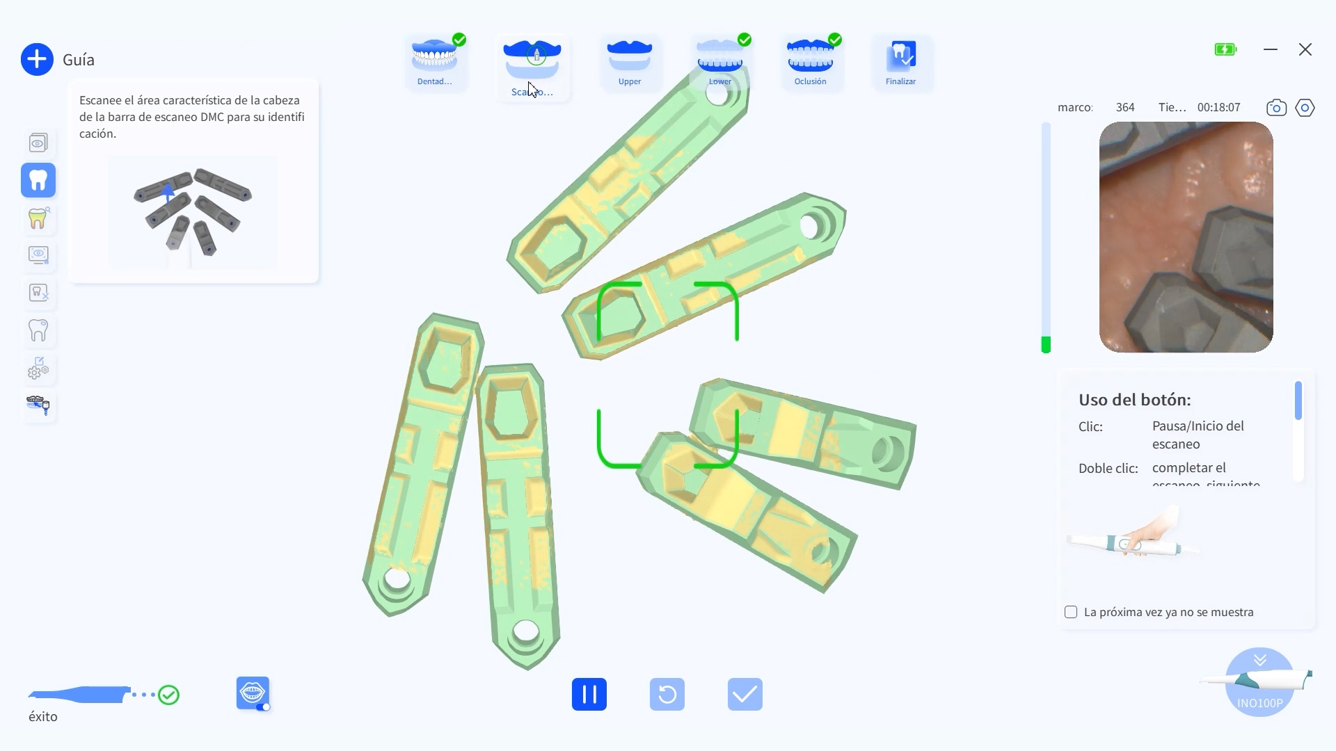 Scanbodies Aura Smart+ - Edentulos - My Lab Dental